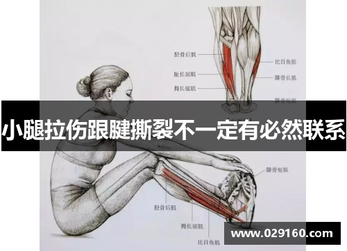 小腿拉伤跟腱撕裂不一定有必然联系